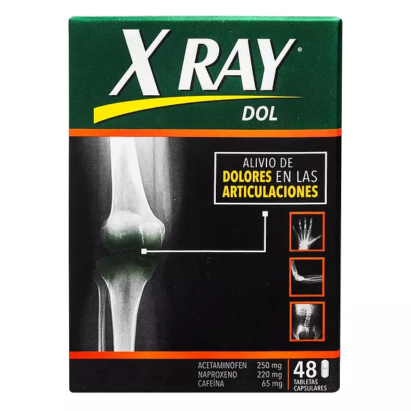 X-Ray Dol 